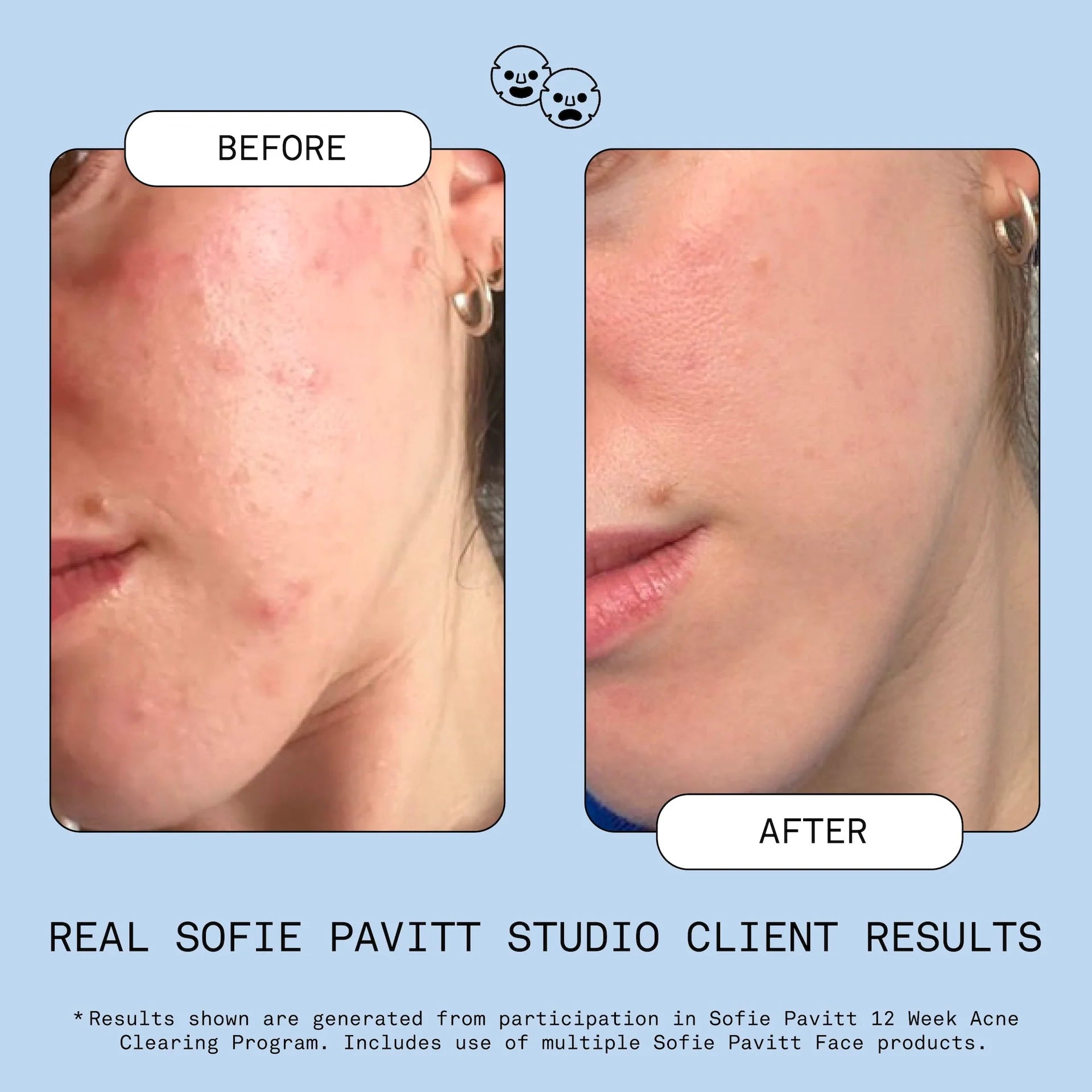 Fridge to Face Blemish Defense Mist, 95 ml
