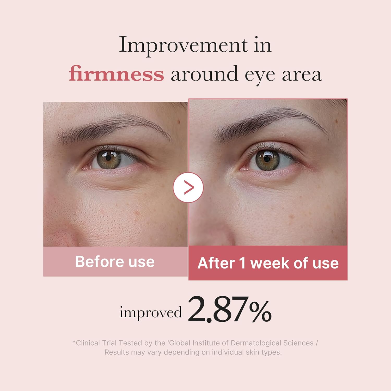 PDRN Pink Peptide Eye Cream