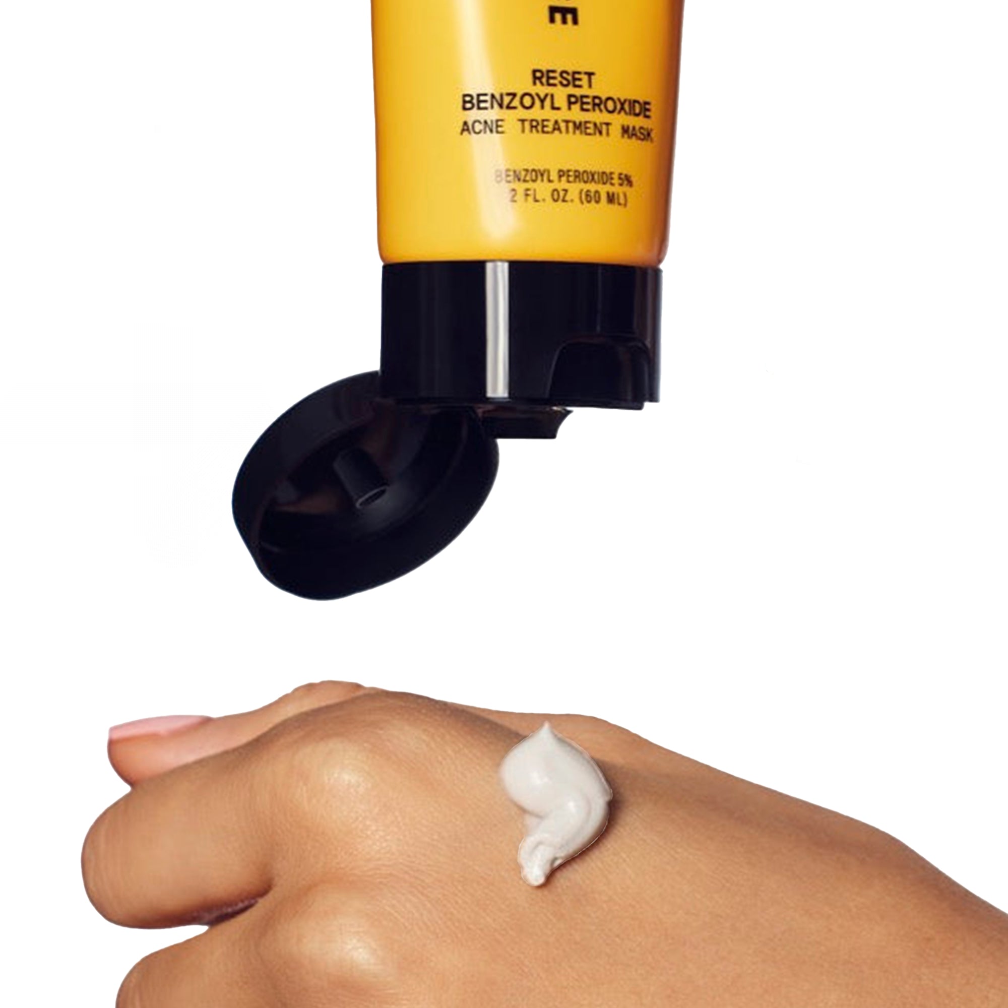 RESET Benzoyl Peroxide Acne Treatment Mask, 2oz